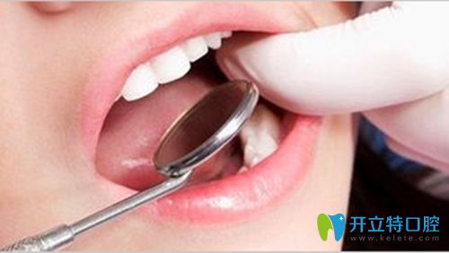 淺談唇腭裂做牙齒矯正的費(fèi)用價(jià)格和注意事項(xiàng)