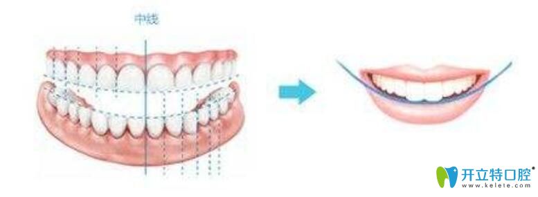 李帥指出珠海愛思特矯正的優(yōu)勢有這些