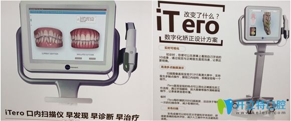 東莞壹加壹口腔口掃儀器 東莞壹加壹口腔口掃儀器