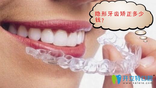 隱形矯正牙齒多少錢?時代天使價格17000元矯正效果好嗎？