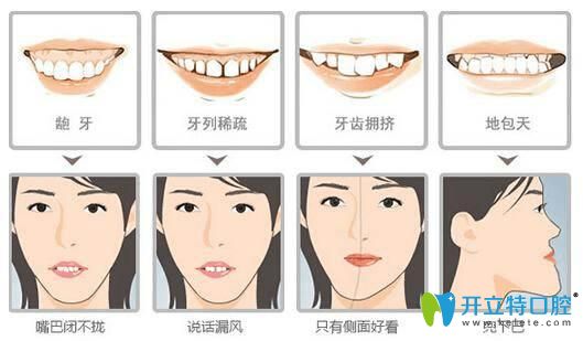 昆明尚愛(ài)韓美口腔孔明星提醒牙齒矯正要盡早