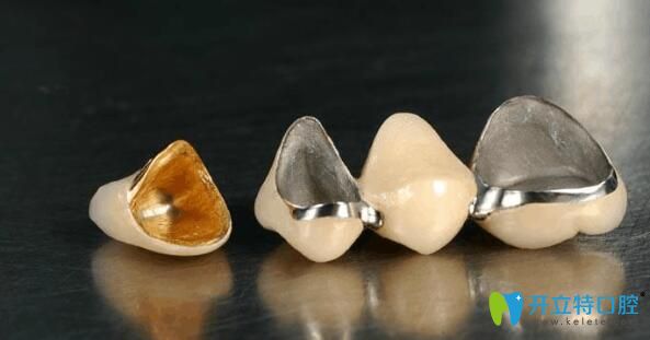 毛佳麗醫(yī)生指出烤瓷牙崩瓷該怎么辦