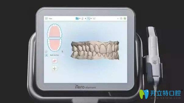 諾德齒科網(wǎng)紅黑科技口掃