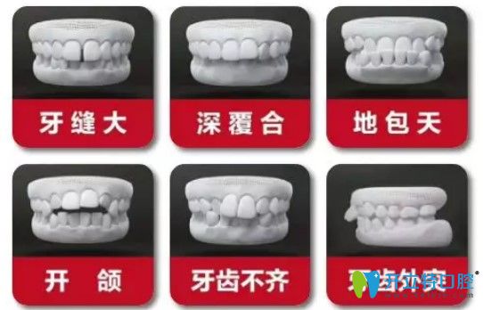 哪些牙齒需要做牙齒矯正圖示