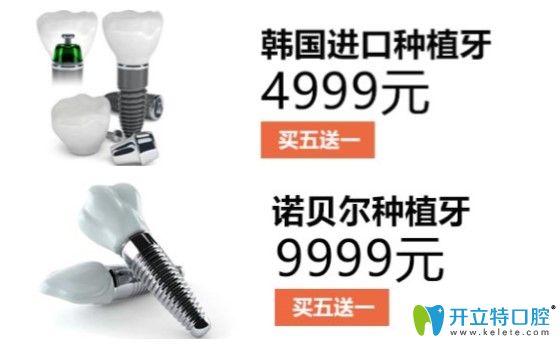 格倫菲爾口腔種植牙價格圖示