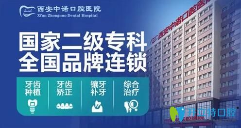 西安種植牙哪家醫(yī)院好？中諾口腔立得用種植牙可靠效果好