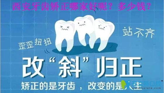 整牙攻略!剛在西安牙齒矯正貼吧整理了7家牙科矯正案例效果