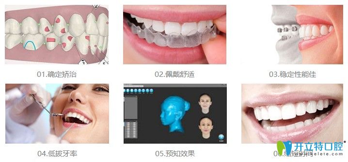 北京維嘉口腔數(shù)字化正畸優(yōu)勢(shì) 北京維嘉口腔數(shù)字化正畸優(yōu)勢(shì)