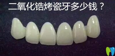 二氧化鋯烤瓷牙多少錢(qián)?價(jià)格800元一顆貴嗎?