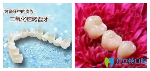 二氧化鋯烤瓷牙致癌是真的嗎