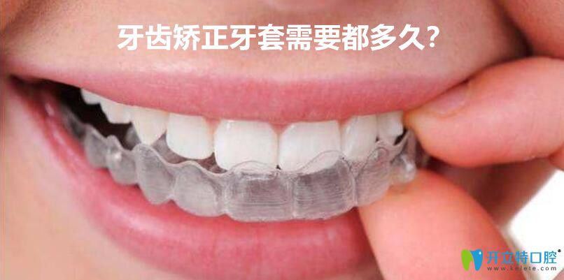牙套要帶多久？牙齒矯正選擇傳統(tǒng)的牙套好還是隱形的好？