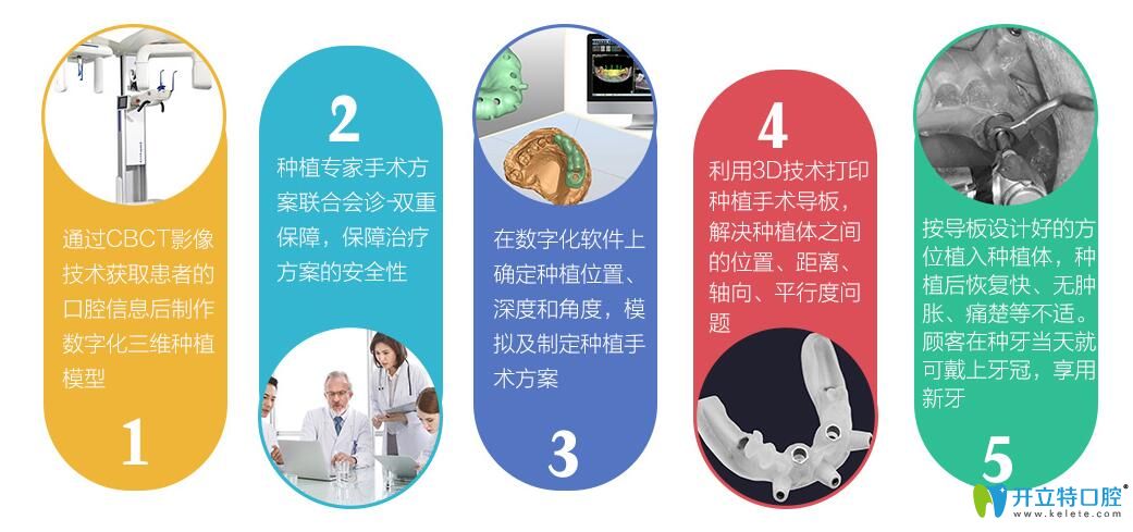 博韻口腔靶向種植技術解析