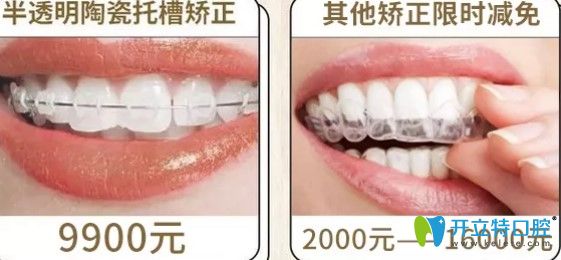 圣貝口腔半隱型矯正和其他矯正優(yōu)惠價格圖