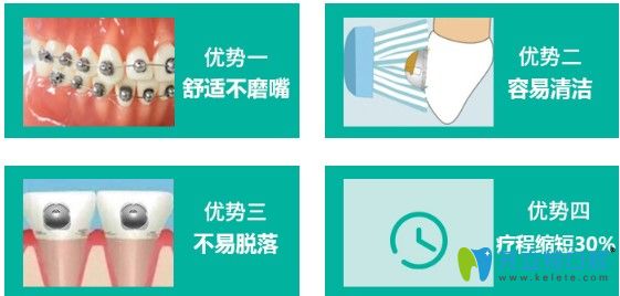 正夫口腔球面自鎖矯正優(yōu)勢圖