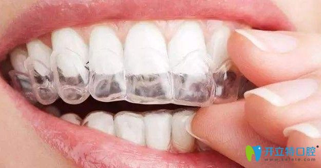 牙齒排整齊后圖片