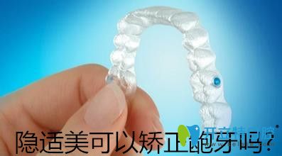 隱適美可以矯正齙牙嗎?用我自己牙齒前突正畸經(jīng)歷告訴你