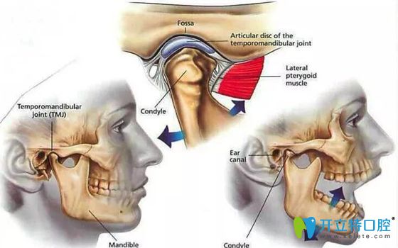 復(fù)發(fā)性顳頜關(guān)節(jié)脫位需注射治療