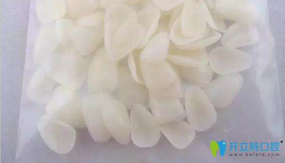 網(wǎng)上售價(jià)幾十元一顆的牙齒貼面圖