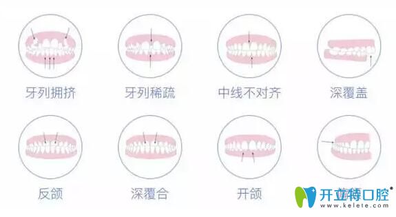 成人牙齒矯正會(huì)反彈嗎?教你如何預(yù)防和避免牙齒矯正后反彈