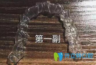 我在煙臺百仕口腔戴的頭一副隱形牙套