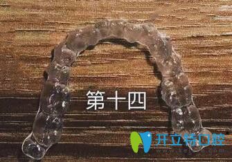 我在煙臺百仕口腔戴的時代天使隱形牙套