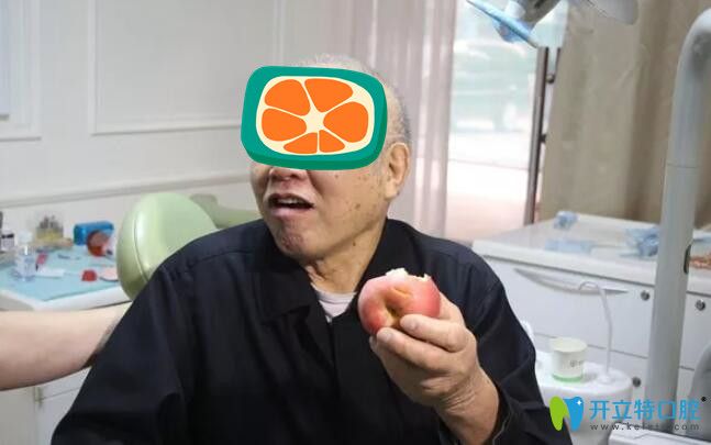 薛啟明半口種植牙術(shù)后效果圖 薛啟明半口種植牙術(shù)后效果圖