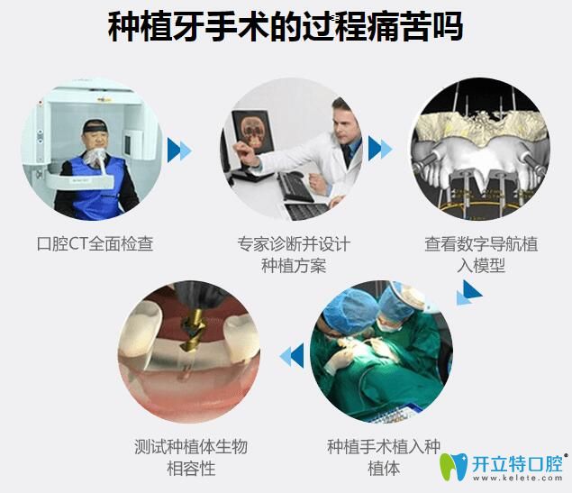 北京瑞鯊口腔吳志強醫(yī)生告訴你種植牙手術疼嗎