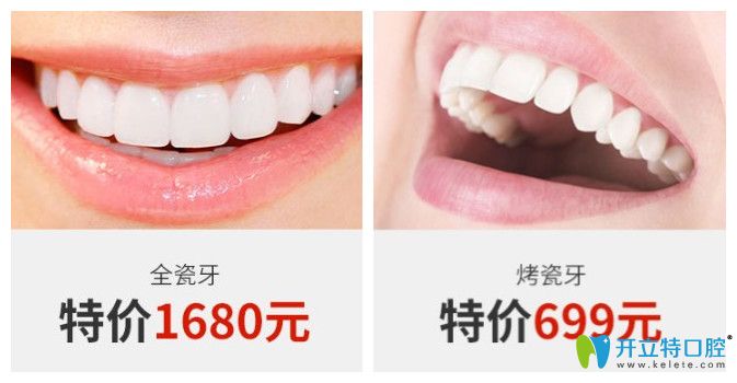 正夫口腔全瓷牙和烤瓷牙價(jià)格圖示