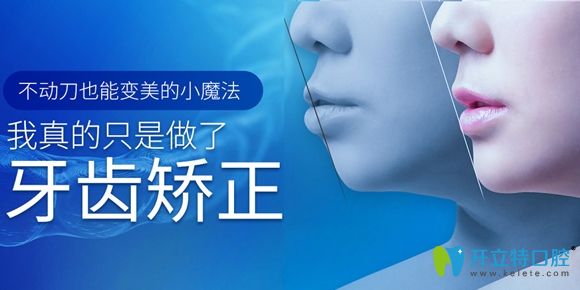 深圳潤(rùn)澤瑞尼絲口腔牙齒矯正宣傳圖 深圳潤(rùn)澤瑞尼絲口腔牙齒矯正宣傳圖