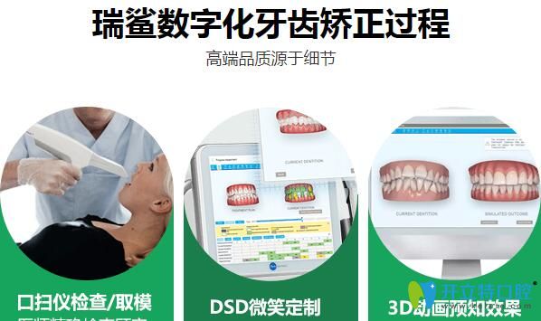 北京瑞鯊口腔數(shù)字化牙齒矯正過(guò)程