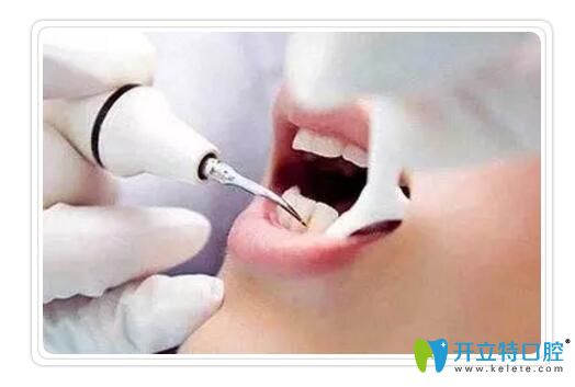 藝星口腔王黨紅說出現(xiàn)黑三角應(yīng)該如何應(yīng)對