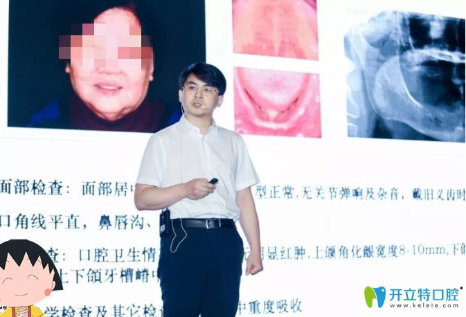 維樂口腔時(shí)紹忠院長(zhǎng)分享全口無牙頜種植案例圖示