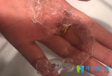 隱適美隱形牙套效果圖