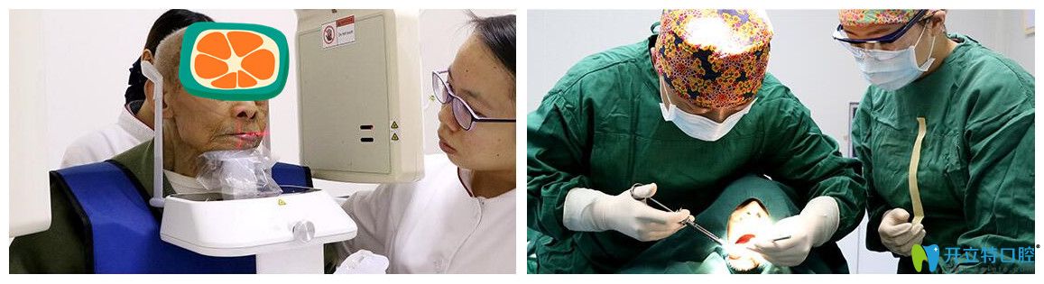 侯主任為韓老實施精準(zhǔn)種植手術(shù)圖