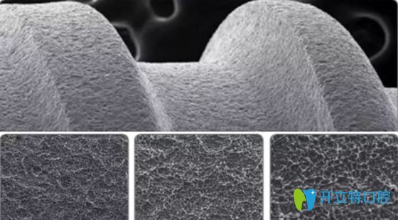 bb種植體采用生物活性（BioActive）表面處理