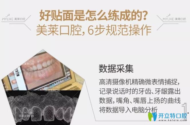 深圳美萊口腔隱形臻薄牙貼面6不規(guī)范操作