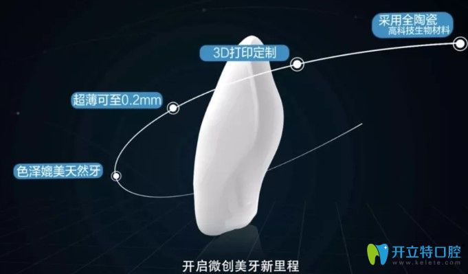 剛開始做的牙齒貼面很失敗，又進(jìn)行了二次瓷貼面修復(fù)