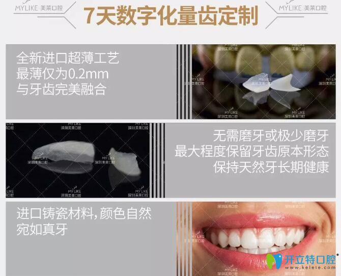 深圳美萊口腔隱形臻薄牙貼面的優(yōu)勢