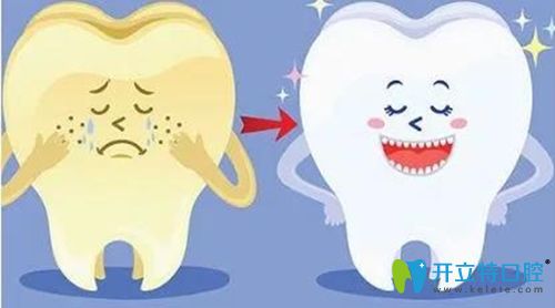 美加牙貼面和義獲嘉牙齒貼面選哪個(gè)更好