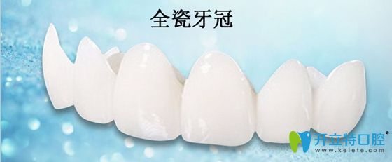 全瓷牙冠展示圖