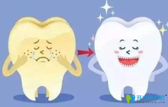 皓齒美白和冷光美白哪個好？看到分別多少錢后我懂了