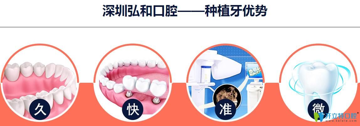 深圳弘和口腔種植牙優(yōu)勢(shì)