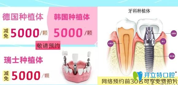 美佳德口腔做種植牙網(wǎng)絡(luò)預(yù)約前30名可享免費(fèi)拍片