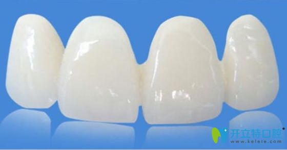 不戴牙套矯正牙齒的美容冠