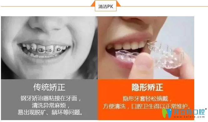 時(shí)代天使隱形矯正優(yōu)勢