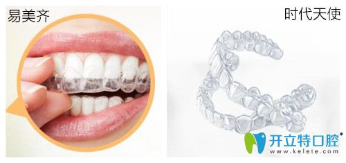 以親身矯正牙齒的感受告知大家易美齊和時(shí)代天使哪個(gè)好？