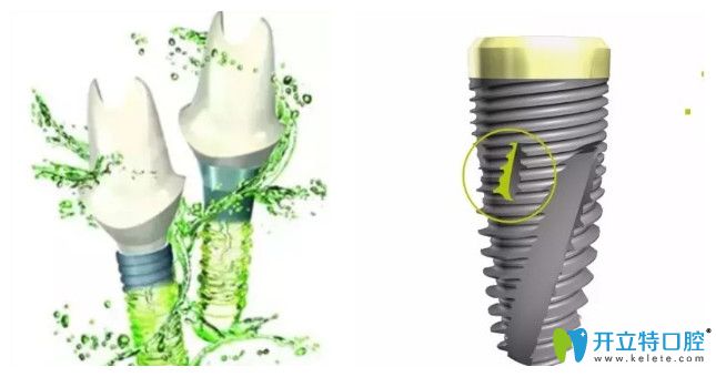 同是瑞士品牌：百丹特和iti種植牙哪個(gè)好價(jià)格更便宜