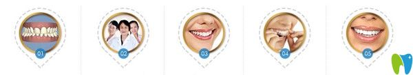 美奧口腔的5大矯正特色 美奧口腔的5大矯正特色