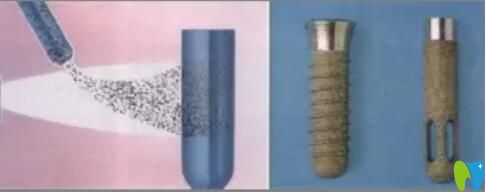 種植體表面噴砂處理