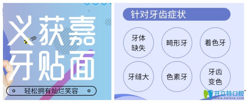 康美口腔義獲嘉超薄牙貼面使用癥狀 康美口腔義獲嘉超薄牙貼面使用癥狀